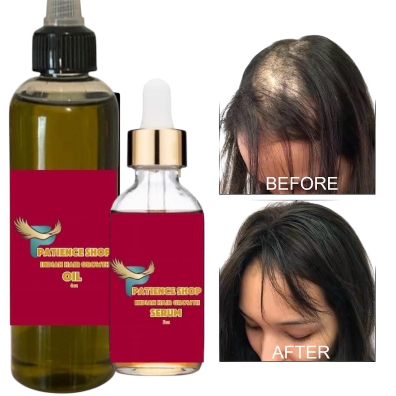 INDIAN HAIR GROWTH OIL 4oz