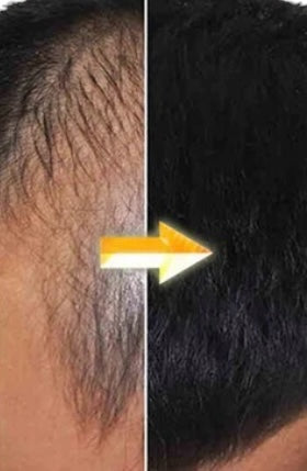 INDIAN HAIR GROWTH SERUM